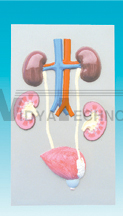 The dissection model of kidney and renal calculus